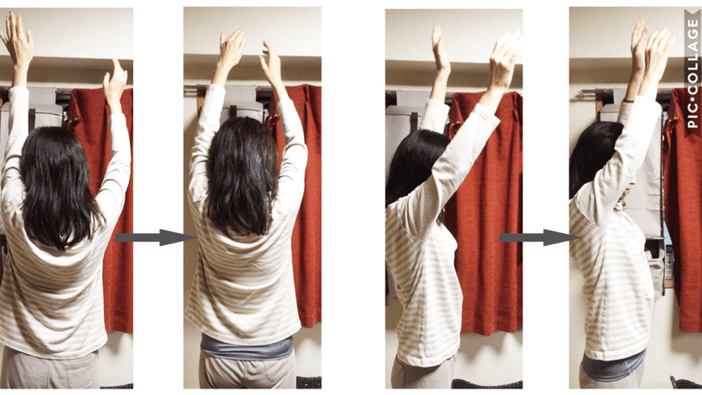 肩の痛み(四十肩・五十肩)で可動域が制限されていた状態から、1回の矯正で肩が高く上がるようになった比較写真