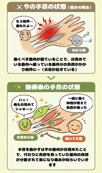 働きすぎて炎症を起こした手首の筋肉が働ける筋肉を施術で起こしたことにより負担が減ったイメージ