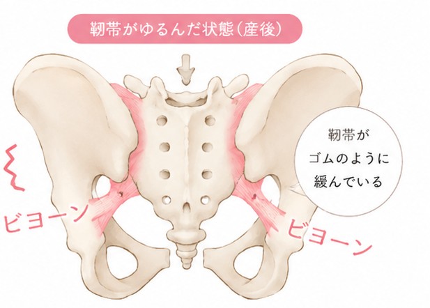 産後の骨盤矯正