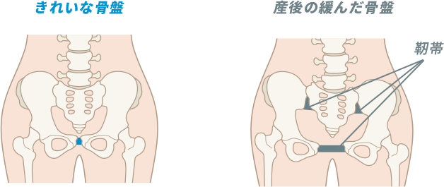 産後の骨盤矯正