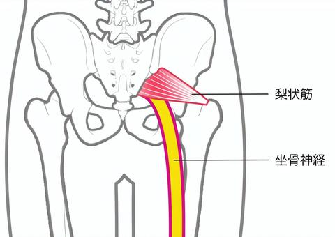 坐骨神経のイラスト