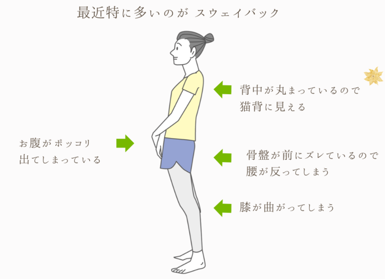 あまり認識されていないスウェイバックと言われる特に多い姿勢の画像